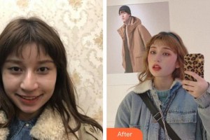 六安市人民醫(yī)院醫(yī)學(xué)美容中心李傳勇整形價(jià)格表附眼部整形案例展示