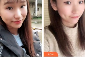 六安皖美口腔門診部馬曉春整形價(jià)格表附牙綜合案例展示