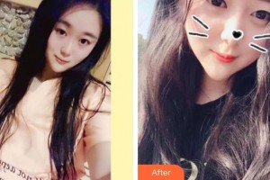 亳州康美口腔醫(yī)院武春勤整形價格表附牙齒矯正案例展示