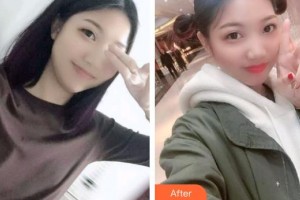 亳州郭琳口腔診所李賀整形價格表附牙綜合案例展示