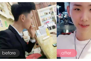 廣州醫(yī)學院第二附屬醫(yī)院整形美容中心風儀萍整形價格表附陰莖延長案例展示