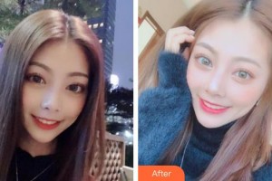 池州博雅口腔門診部黃金華整形價(jià)格表附冷光美白案例展示