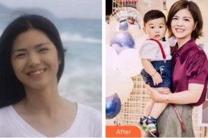 宣城為民口腔門診部王縱波整形價(jià)格表附牙齒隱形矯正案例展示