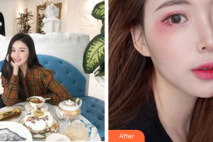 廣州博仕整形美容醫(yī)院高吉整形價格表附芭比雙眼術(shù)案例展示