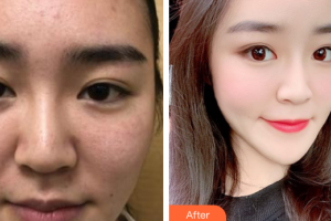 廣州圣諾達(dá)醫(yī)療美容門診部曹珂整形價格表附抗衰產(chǎn)品案例展示