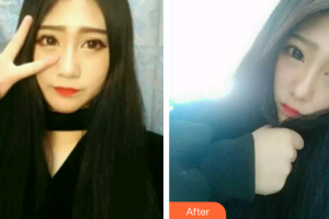 廣州穗華口腔醫(yī)院張修學(xué)整形價格表附時代天使矯正案例展示