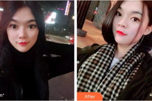 廣州穗華口腔醫(yī)院劉敏義整形價格表附時代天使矯正案例展示