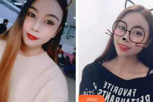 廣州穗華口腔醫(yī)院初放整形價格表附牙齒瓷貼面案例展示