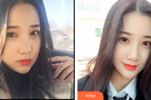 廣州穗華口腔醫(yī)院王俊杰整形價(jià)格表附冷光美白案例展示