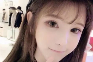 衡陽雅美醫(yī)療美容醫(yī)院王曉朋整形價(jià)格表附鐳射凈膚案例展示