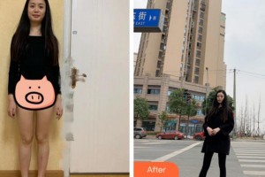 杭州新友好整形醫(yī)院張智云整形價(jià)格表附吸脂瘦大腿案例展示