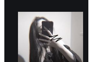 衡陽愛爾眼科醫(yī)院羅偉整形價(jià)格表附切開雙眼皮案例展示