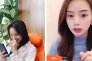 杭州時光醫(yī)療美容醫(yī)院黃志雄整形價格表附超聲波潔牙案例展示