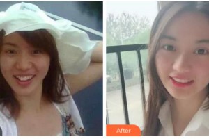 杭州愛琴海醫(yī)療美容醫(yī)院王劍整形價(jià)格表附牙齒陶瓷矯正案例展示