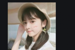 岳陽愛思特醫(yī)療美容醫(yī)院李比整形價格表附眼部綜合案例展示