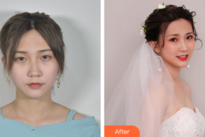 廣州聯(lián)合麗格醫(yī)療美容門診部葉海洲整形價格表附眼部綜合案例展示