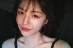 岳陽愛思特醫(yī)療美容醫(yī)院楊國正整形價格表附清潔祛痘案例展示