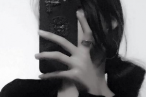 岳陽愛思特醫(yī)療美容醫(yī)院盧夢整形價格表附激光祛斑案例展示