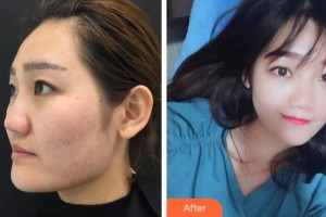 杭州維多利亞醫(yī)療美容醫(yī)院許秀珍整形價格表附抗衰老案例展示