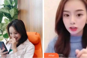 杭州維多利亞醫(yī)療美容醫(yī)院黃仁輝整形價格表附超聲波潔牙案例展示