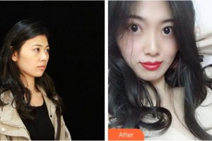 杭州格萊美整形美容醫(yī)院牛勇敢整形價格表附鼻部綜合案例展示