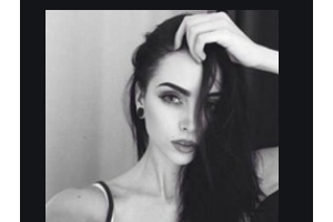 常德燒傷整形醫(yī)院魯世聞?wù)蝺r(jià)格表附自體脂肪全臉填充案例展示