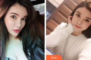 杭州美奧口腔門診部杜永濤整形價(jià)格表附超聲波潔牙案例展示