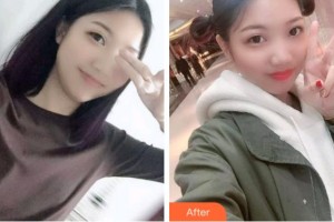 義烏杭州口腔門診部王仁飛整形價(jià)格表附根管調(diào)節(jié)案例展示