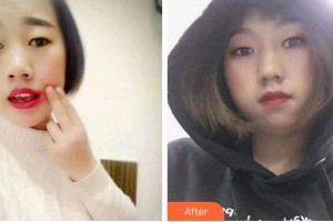 杭州協(xié)友口腔門診部沈月忠整形價(jià)格表附根管調(diào)節(jié)案例展示