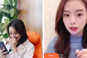 杭州品凱口腔醫(yī)院韓睿整形價格表超聲波潔牙案例展示