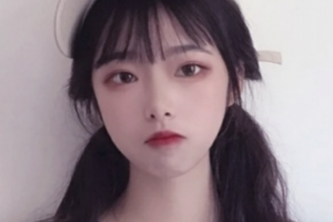 常德愛(ài)爾眼科醫(yī)院林波整形價(jià)格表附切開(kāi)雙眼皮案例展示