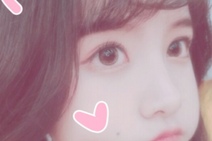 常德口腔醫(yī)院倪星原整形價(jià)格表附牙貼面案例展示