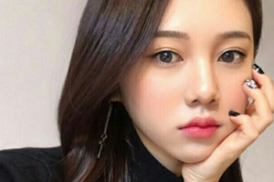 常德市第一中醫(yī)醫(yī)院眼科黃凌飛整形價(jià)格表附牙齒隱形矯正案例展示