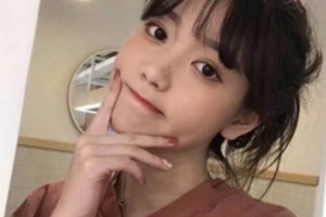 常德市第一中醫(yī)醫(yī)院眼科劉芳瓊整形價(jià)格表附牙齒隱形矯正案例展示