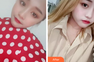 中信惠州醫(yī)院醫(yī)學(xué)整形中心周球律整形價(jià)格表附水光補(bǔ)水案例展示