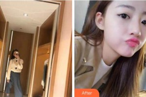 杭州品凱口腔醫(yī)院黃劍奇整形價格表附牙齒隱形矯正案例展示