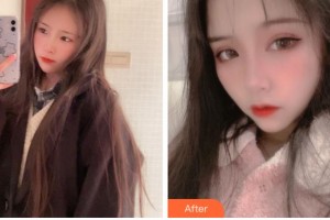 杭州愛(ài)爾眼科醫(yī)院許英整形價(jià)格表附切開(kāi)雙眼皮案例展示