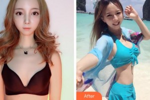 寧波珈禾整形?？漆t(yī)院雷中元整形價格表附自體脂肪隆胸案例展示