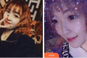 寧波珈禾整形?？漆t(yī)院鮑海素整形價格表附超聲波潔牙案例展示