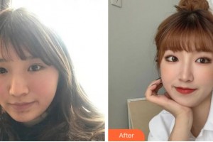 寧波鄔立新醫(yī)療美容診所黃燕麗整形價格表附激光祛斑案例展示