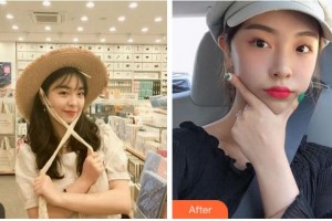 寧波陳標(biāo)新整形美容醫(yī)院裴峻晟整形價(jià)格表附熱拉提案例展示