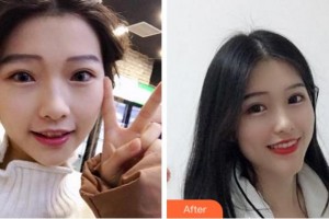 寧波薇琳醫(yī)療美容門(mén)診部文承真整形價(jià)格表附牙齒隱形矯正案例展示