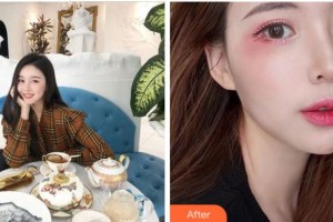 寧波韓美醫(yī)療美容門診部厲春玲整形價格表附眼部綜合案例展示