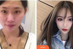 寧波牙博士口腔醫(yī)院王道軍整形價格表附眼部綜合案例展示