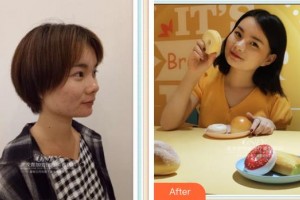 寧波千口百惠口腔門(mén)診部程海標(biāo)整形價(jià)格表附牙齒隱形矯正案例展示