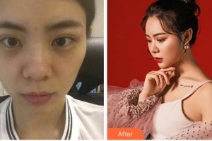 溫州藝星醫(yī)學美容醫(yī)院錢輝整形價格表附眼部修復案例展示