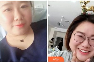 溫州藝星醫(yī)學(xué)美容醫(yī)院韋克新整形價格表附牙齒隱形矯正案例展示