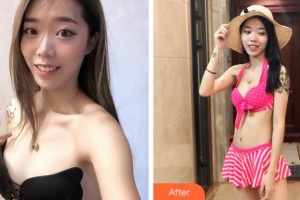 溫州醫(yī)學(xué)院附屬第一醫(yī)院整形外科趙進(jìn)軍整形價格表附自體脂肪隆胸案例展示