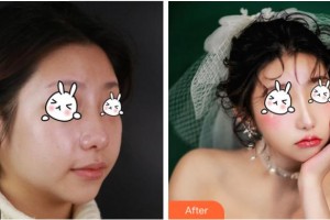 溫州和平整形醫(yī)院嚴(yán)園園整形價格表附激光祛斑案例展示