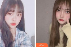 溫州芘麗芙美容醫(yī)院程軍整形價格表附開內眼角案例展示